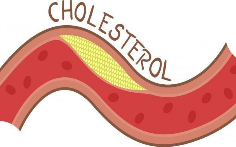 sau-rieng-va-cholesterol-3
